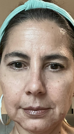 <em>Claudia, 52</em>